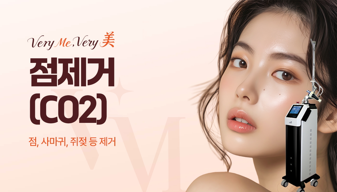 점제거(CO2)